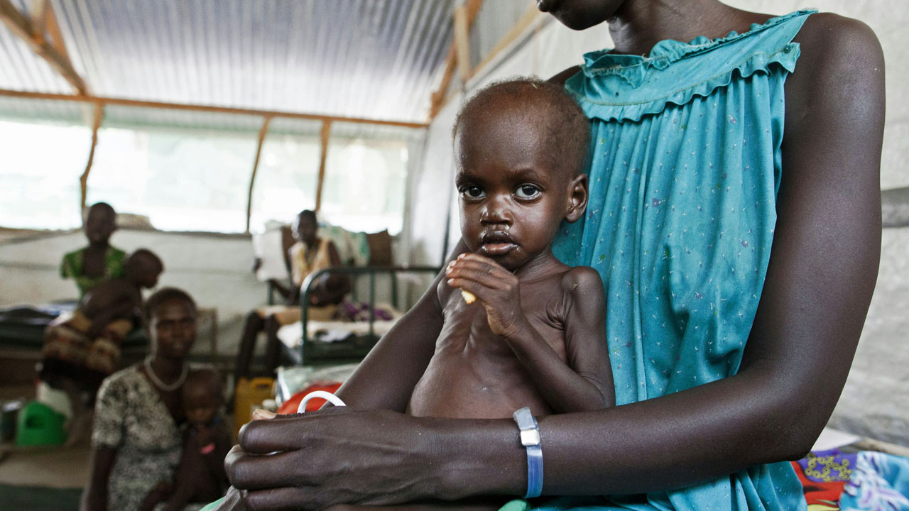 Malnutrition in African children: the warning signs every parent should know